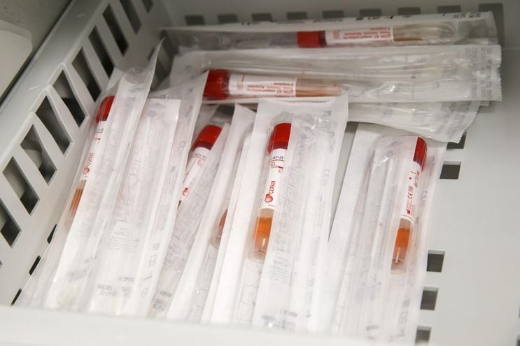 Tubos para almacenar muestras de personas sospechosas de estar infectadas con el coronavirus.
