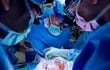 Cirugía de transplante de riñón de un cerdo genéticamente modificado a una mujer, en Nueva York.