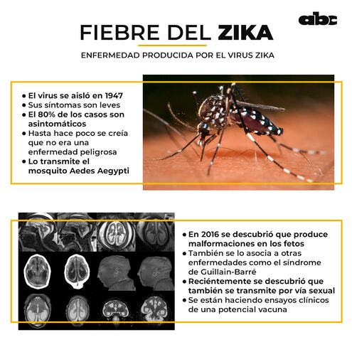 Fiebre del Zika