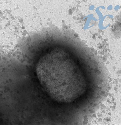 Obtienen la secuencia completa del virus de la viruela del mono en España -  Ciencia - ABC Color