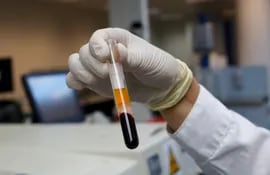 Un empleado de un laboratorio en Israel sostiene muestras de sangre para test serológico.