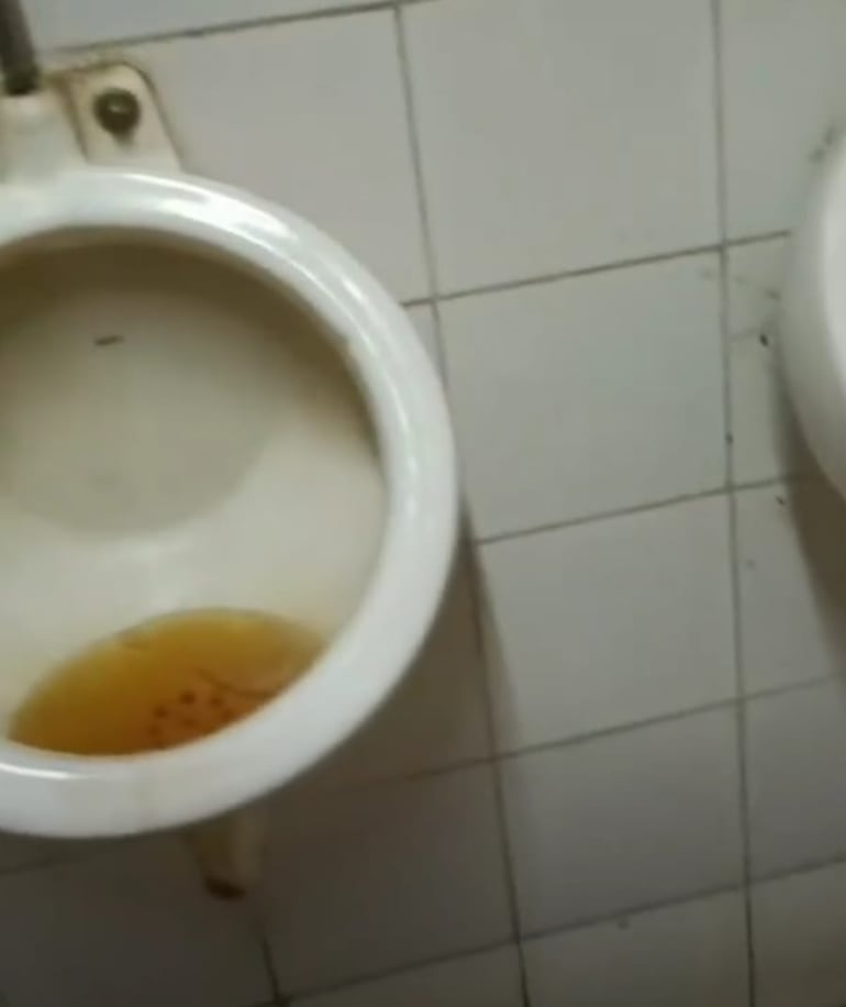 Denuncian deplorable estado de los baños del Hospital Regional de Caacupé Denuncian deplorable estado de los baños del Hospital Regional de Caacupé