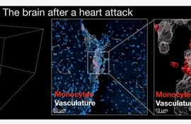 El corazón envía después de sufrir un infarto algunas señales al cerebro para desencadenar unos mayores deseos de dormir y acelerar así el proceso de recuperación, ya que ese descanso puede contribuir a reducir la inflamación.Lo han comprobado científicos del Hospital Mount Sinai de Nueva York, uno de los centros de referencia a nivel mundial en investigación y cirugía cardíaca y vascular, y los resultados de su trabajo, que este miércoles se publican en la revista Nature, demuestran por primera vez cómo corazón y cerebro se comunican entre sí a través del sistema inmunitario para favorecer el sueño y la recuperación tras un episodio cardiovascular grave. En la imagen, comportamiento del cerebro de un ratón tras un infarto.