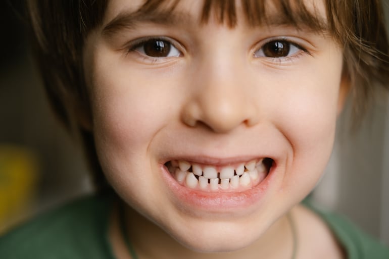 Concepto de dientes de leche.