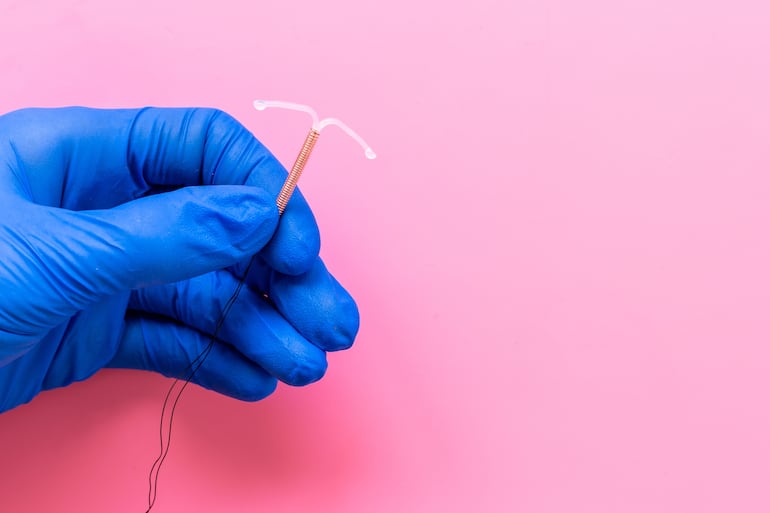 Dispositivo intrauterino (DIU).