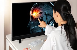 Imagen de referencia: la meningitis se caracteriza por la inflamación de las meninges; la capa que cubre el cerebro.