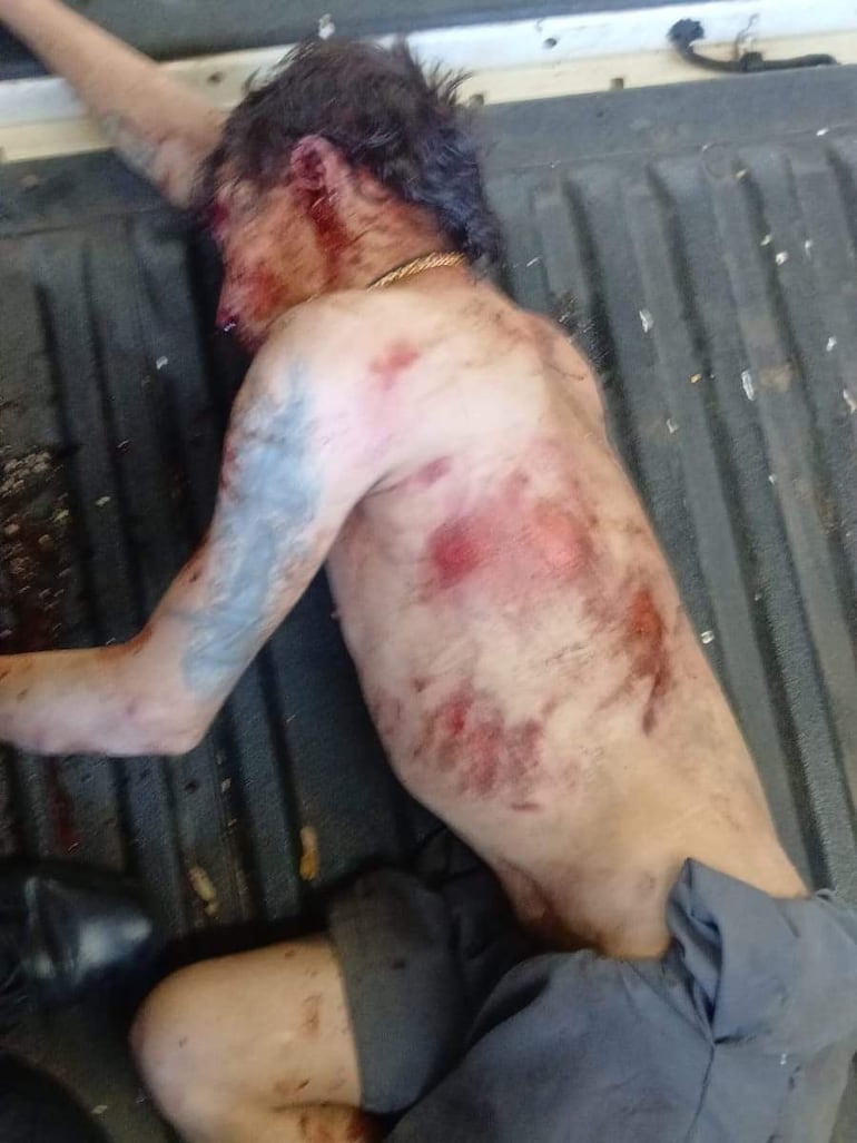 Carlos Gabriel Jara Olmedo, con lesiones visibles, es asistido por agentes de policía uniformados en un entorno tenso.