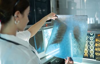 Una radióloga examina una radiografía de tórax