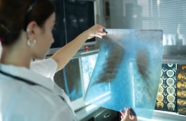 Una radióloga examina una radiografía de tórax
