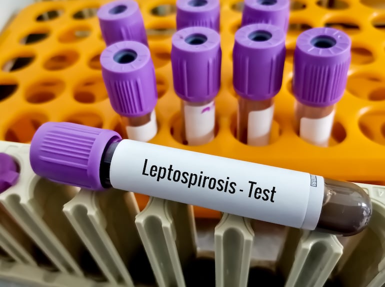 Test de leptospirosis.