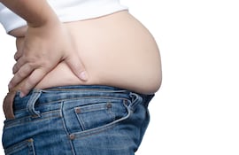 Uno de los principales síntomas del SIBO es la distensión abdominal (barriga que se infla).