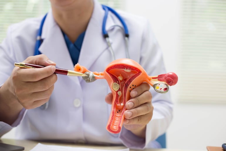 Concepto de salud ovárica.