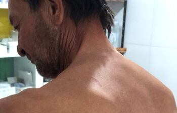 Bienvenido Rojas, de 64 años de edad, denunció que fue agredido por su sobrino, el abogado Ever Ramón Rojas. Le letrado niega el hecho que se le adjudica.