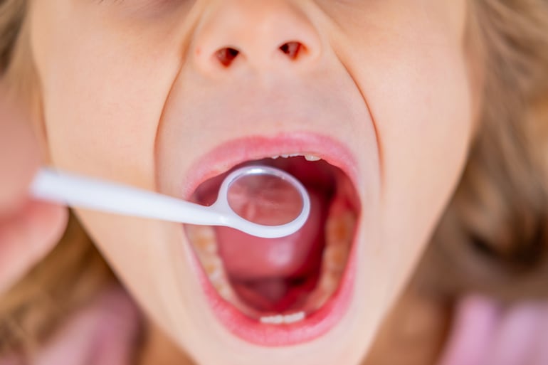 Concepto de dientes de leche.
