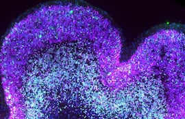 El síndrome de Down altera el desarrollo del cerebro humano antes del nacimiento y ahora un equipo de investigadores ha creado un mapa molecular que explica cómo, lo que podría servir para desarrollar estrategias terapéuticas en el futuro.