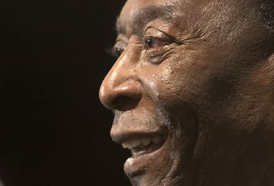 Edson Arantes do Nascimento, Pelé, es para muchos el mejor futbolista de la historia.