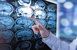 Médicos recuerdan la importancia del tratamiento oportuno en pacientes con esclerosis múltiple.