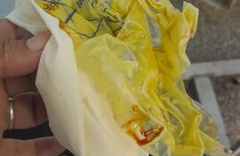 Bolsa colectora de orina, ya en estado de descomposición, que extrajeron de la herida de doña Victorina, quien se operó en octubre en el Hospital Regional IPS de Ciudad del Este.