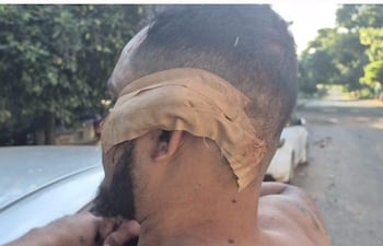 La víctima con herida cortante Carlos Ramón Valdez González.