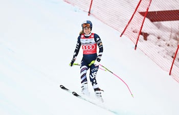 La norteamericana Lindsey Vonn, pese a la rotura completa de ligamento cruzado, no renuncia a participar en los Juegos Olímpicos de Invierno, en el esquí.
