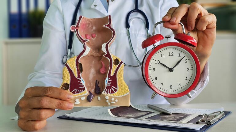 ¿Cuándo ir al coloproctólogo?