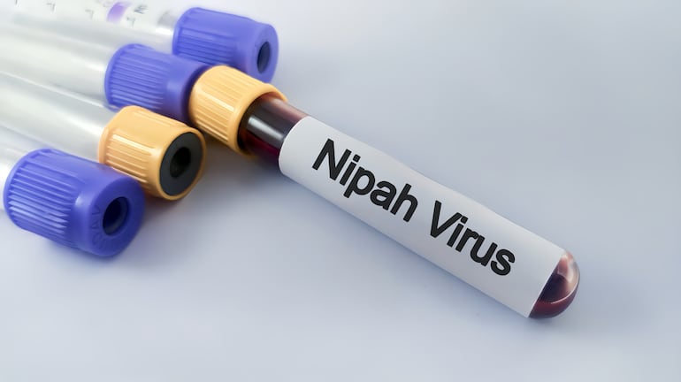 Virus Nipah, imagen ilustrativa.