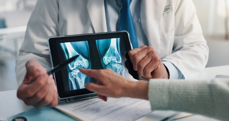 Médico sostiene un estudio de los huesos.