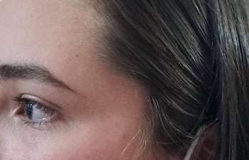 Alejandra Monserrat Bedoya Galeano lamentó la agresión sufrida, pidiendo castigo para su atacante, Perla Acosta