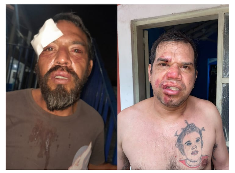 Denuncian presunta golpiza en sede policial