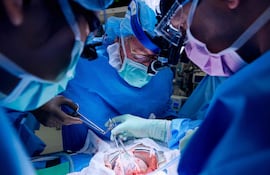 Cirugía de transplante de riñón de un cerdo genéticamente modificado a una mujer, en Nueva York.