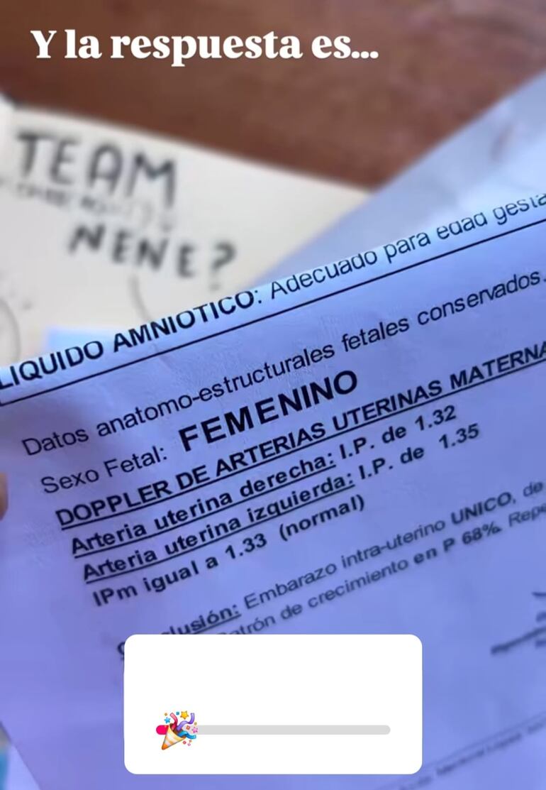 Así Fio Migliore contó a sus seguidores que una nena está en camino. (Captura de la historia de Instagram de Fiorella Migliore)
