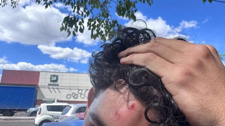 Adolescente de cabello oscuro y rizado se toca la cabeza con una mano, mostrando una herida en un entorno urbano.