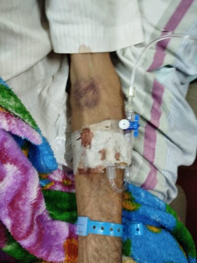 En Eusebio Ayala claman por el traslado urgente de un paciente con ACV ante la crítica situación del hospital.