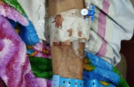 En Eusebio Ayala claman por el traslado urgente de un paciente con ACV ante la crítica situación del hospital.