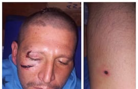 La víctima, Nicolás Flecha Gómez, de 31 años, sufrió heridas en el rostro y la cabeza, además de impactos de arma de fuego en el muslo y el brazo.
