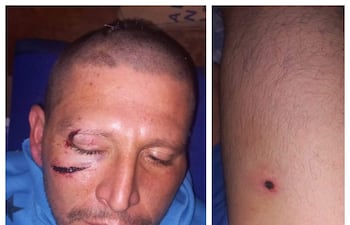 La víctima, Nicolás Flecha Gómez, de 31 años, sufrió heridas en el rostro y la cabeza, además de impactos de arma de fuego en el muslo y el brazo.