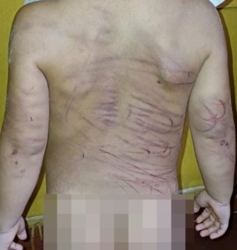 Así quedó el niño de tres años luego de los golpes recibidos por parte de la pareja de su mamá. 