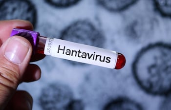 Descubren el ‘punto débil’ del hantavirus andino y abren la vía para posibles tratamientos.