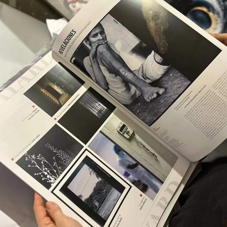 Revista abierta con fotografías en blanco y negro, muestra al joven con herida visible en un ambiente artístico y sombrío.