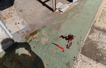 Policía resultó herido cuando intentaba evitar que una mujer se autolesione.