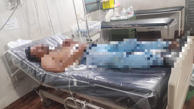 El herido se encuentra internado en el Hospital Regional de Paraguarí.