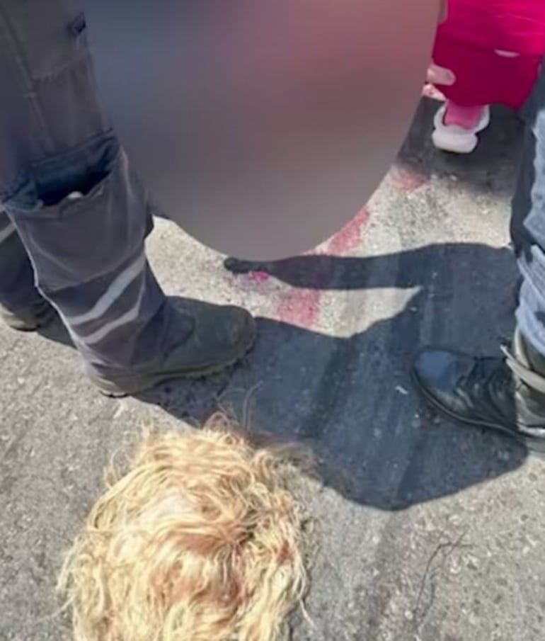 Así quedó el cabello tendido en el asfalto tras el fuerte accidente de tránsito en Lambaré, entre un colectivo y una motocicleta.