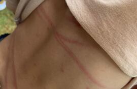 El niño quedó con rastros del castigo físico en varias partes del cuerpo.