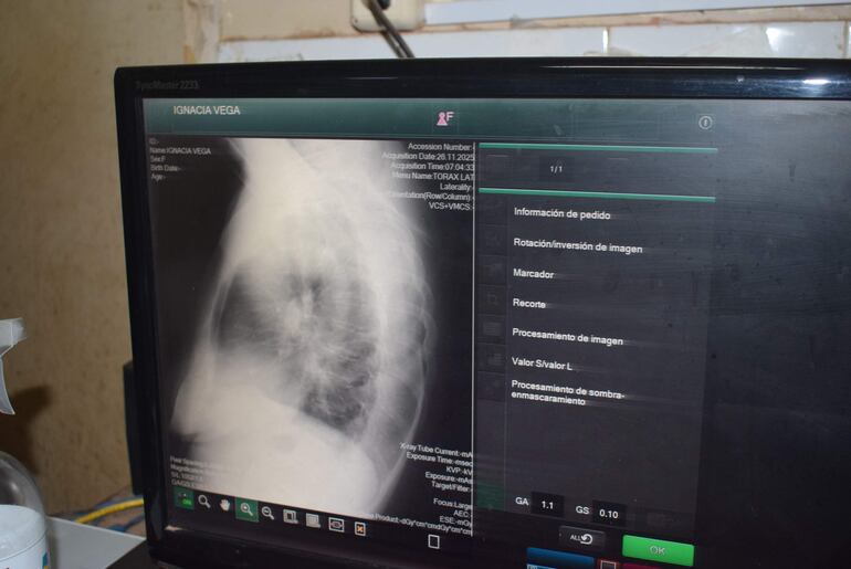 Ante la falta de placas, los pacientes deben tomar una foto con sus celulares para mostrar al traumatólogo.