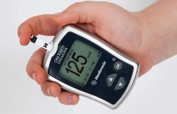 Fotografía cedida por el Instituto de Ciencias Agrícolas y Alimentarias de la Universidad de Florida (UF/IFAS) de un dispositivo para el monitoreo de la diabetes. Científicos descubrieron que es posible detectar signos tempranos de diabetes tipo 1 en la sangre del cordón umbilical, informó este miércoles la UF.