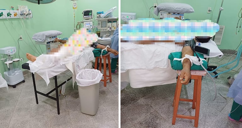 Un paciente fue operado sobre una camilla básica en el Instituto de Medicina Tropical por la avería de una mesa quirúrgica.
