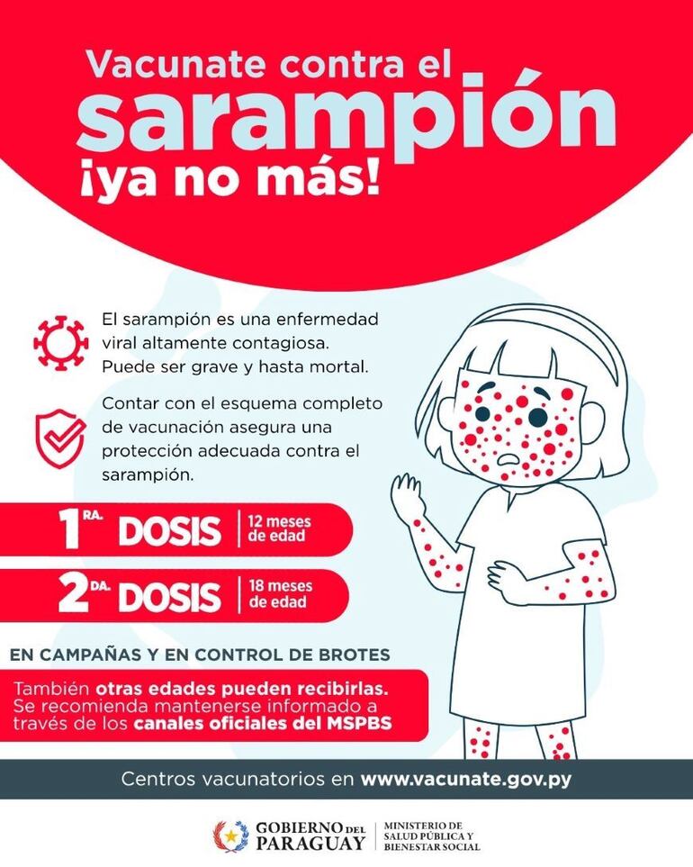 Datos sobre el sarampión.