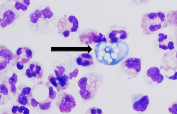 Naegleria fowleri, conocida como ameba "comecerebros".