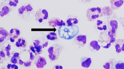 Naegleria fowleri, conocida como ameba "comecerebros".