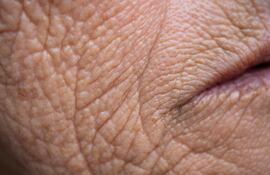 Envejecimiento, arrugas en la piel, imagen ilustrativa.